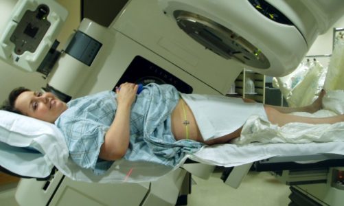 Ochrona skóry w trakcie i po radioterapii