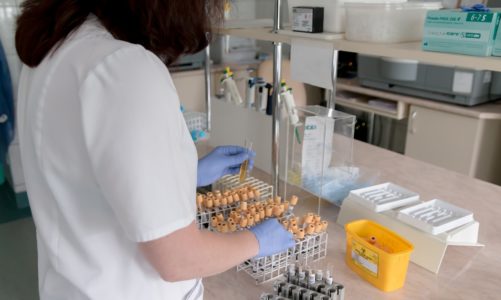 Badania laboratoryjne – co możemy z nich wyczytać?