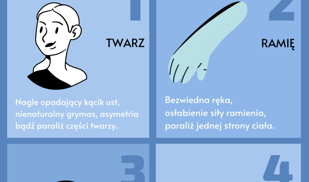 Udar mózgu – co trzeba wiedzieć: Spastyczność poudarowa, czyli jak odzyskać sprawność po udarze